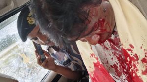 বিপর্যয়ের দিনেও রাজনৈতিক হামলার শিকার বিজেপির সাংসদ ও বিধায়করা, আক্রান্ত সাংসদ ও শঙ্কর ঘোষ সহ আরেক বিধায়ক (Khagen Murmu and sankar ghosh attacked) 2 Khagen Murmu and sankar ghosh attacked