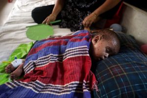 Measles in Bangladesh